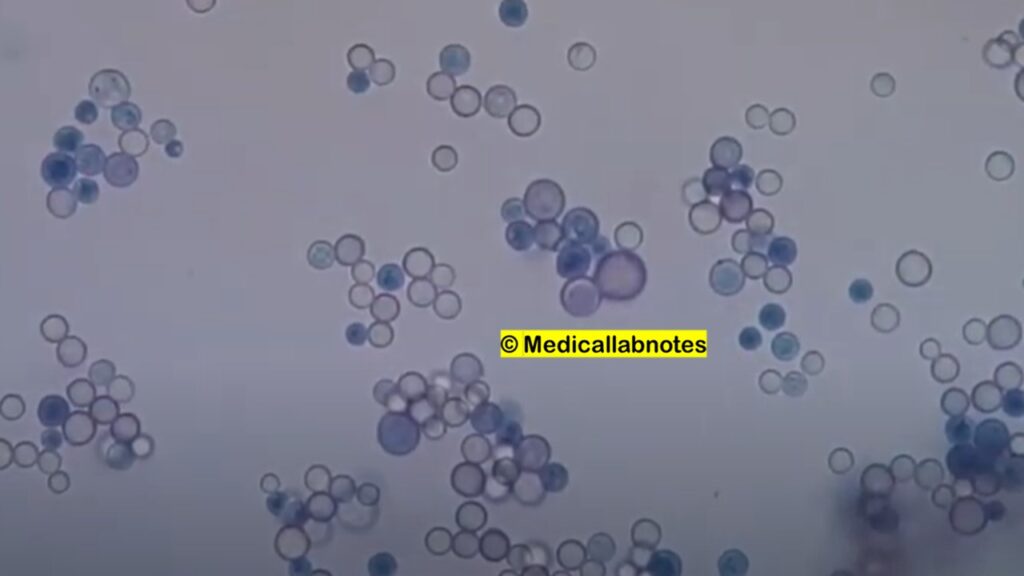 Live and Dead Cryptococcus neoformans Footages in Methylene Blue wet mount Microscopy