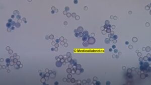 Cryptococcus: Introduction, Morphology, Pathogenicity, Lab Diag