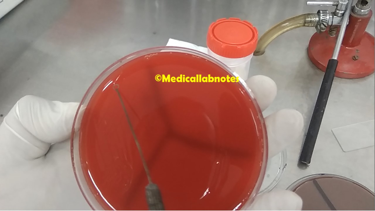 A step of sample inoculation on blood agar for Sputum Culture and Sensitivity