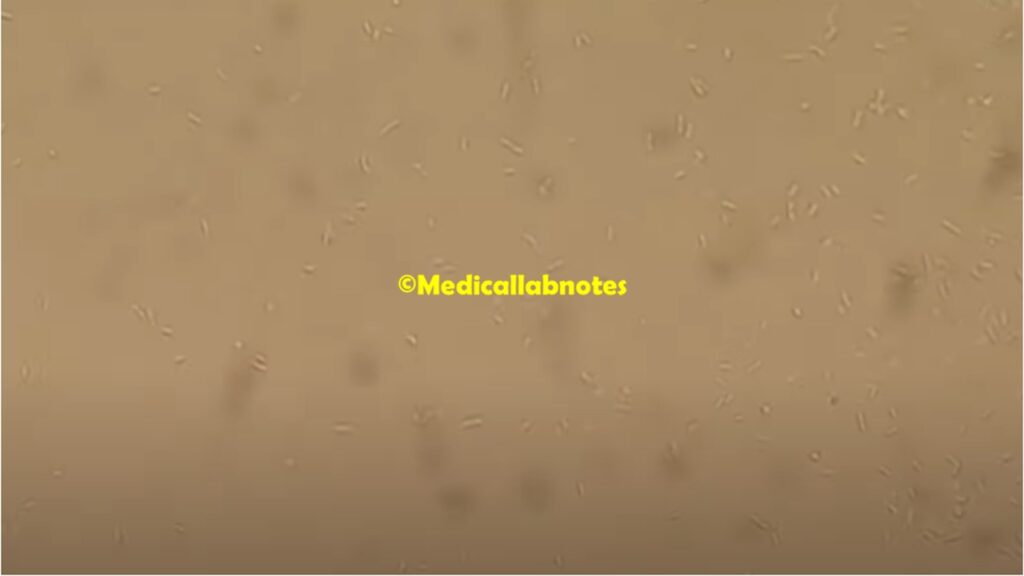 Achromobacter in wet mount of Tryptone soy broth microscopy