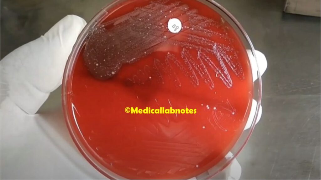 Alpha haemolytic colony of Pneumococcus on blood agar of clinical specimen, sputum culture showing no growth around optochin disk