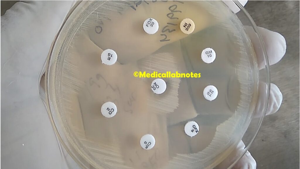 Antibiotic Susceptibility Testing (AST) of  Staphylococcus saprophyticus