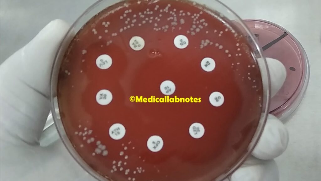 Antimicrobial Susceptibility Testing (AST) pattern of Streptococcus agalactiae