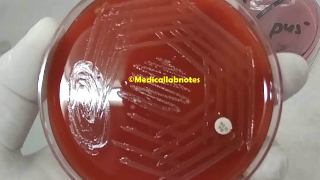 Bacitracin (0.04U) Resistant Streptococcus agalactiae on blood agar