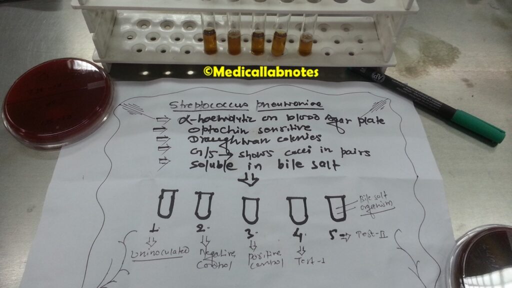 Bile solubility test positive Streptococcus pneumoniae