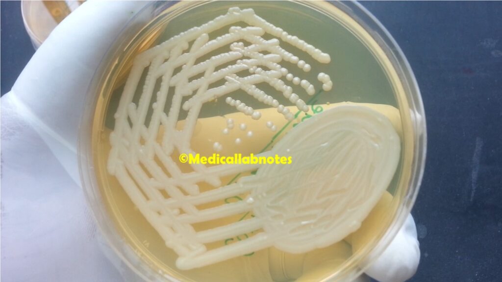 Corynebacterium diphtheriae colony characteristics on Muller-Hinton agar (MHA)