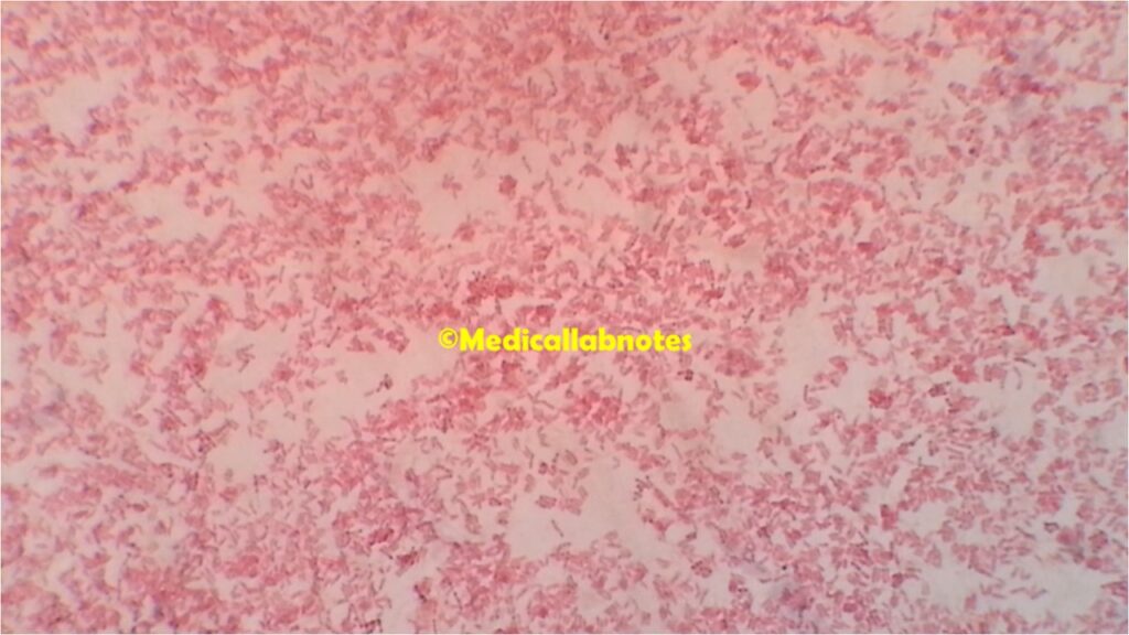 Corynebacterium diphtheriae in Neisser staining of culture microscopy