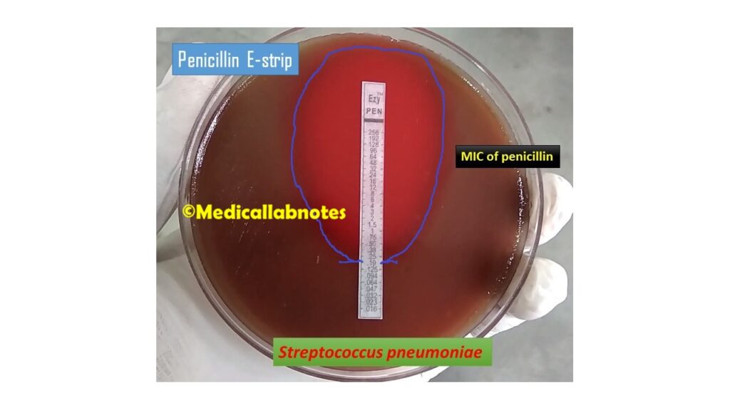 Determination of Penicillin MICs for Streptococcus pneumoniae 