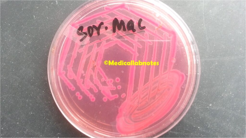 E. coli O157:H7 growth on Sorbitol-MacConkey agar (white colony at centre)