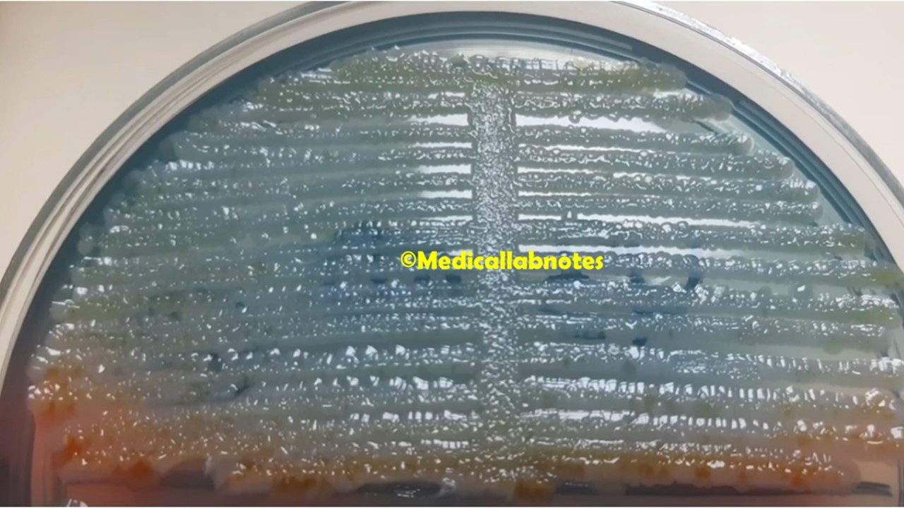 Enterobacter aerogenes colony morphology on CLED agar of urine culture