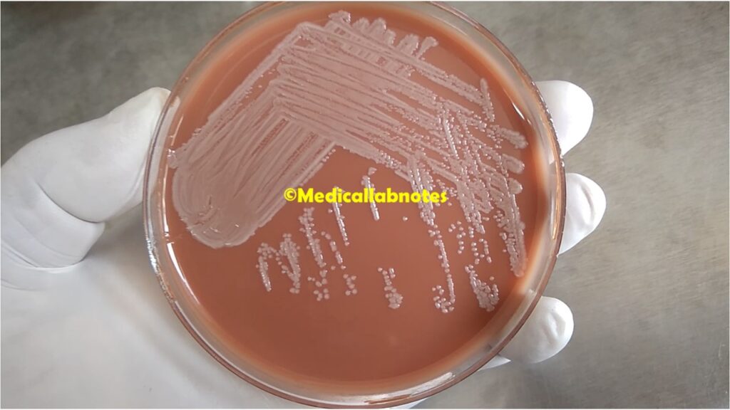 Escherichia coli (E. coli) growth on chocolate agar