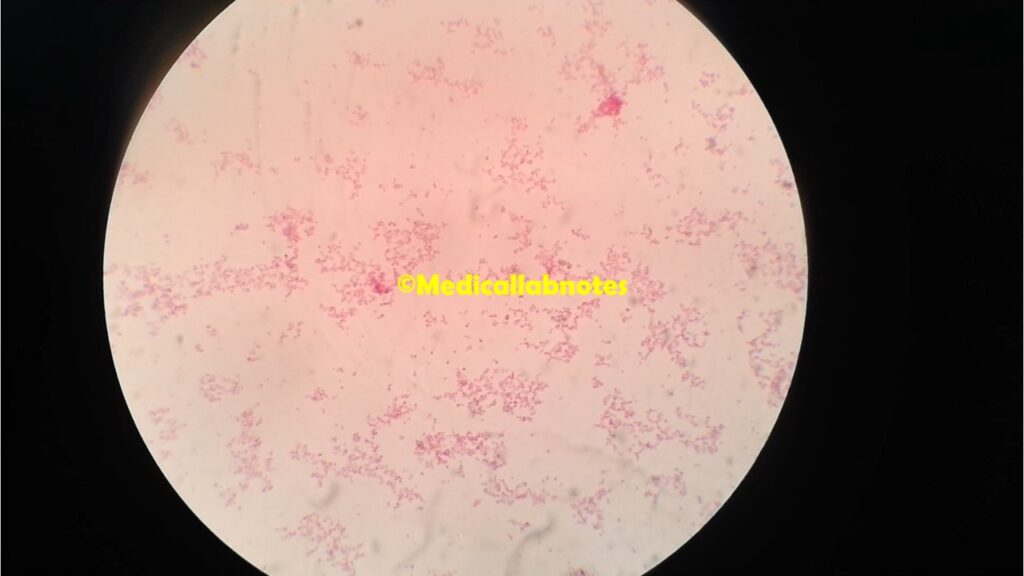 Gram negative cocci in pairs (diplococci) of Moraxella catarrhalis in Gram staining of culture microscopy at a magnification