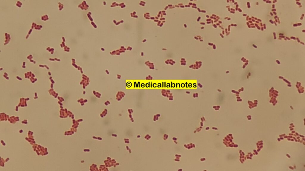 Gram negative rods (GNRs) of Stenotrophomonas maltophilia in Gram staining of culture microscopy at a magnification of 4000X