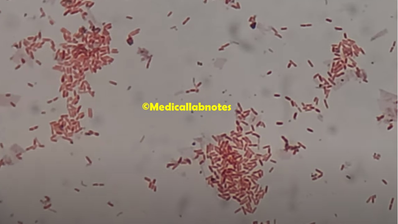 Gram negative rods (GNRs) or Gram negative bacilli (GNBs)of Achromobacter xylosoxidans in Gram staining of culture microscopy