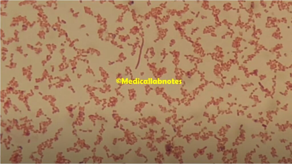 Gram negative rods of E. aerogenes in Gram staining of culture microscopy