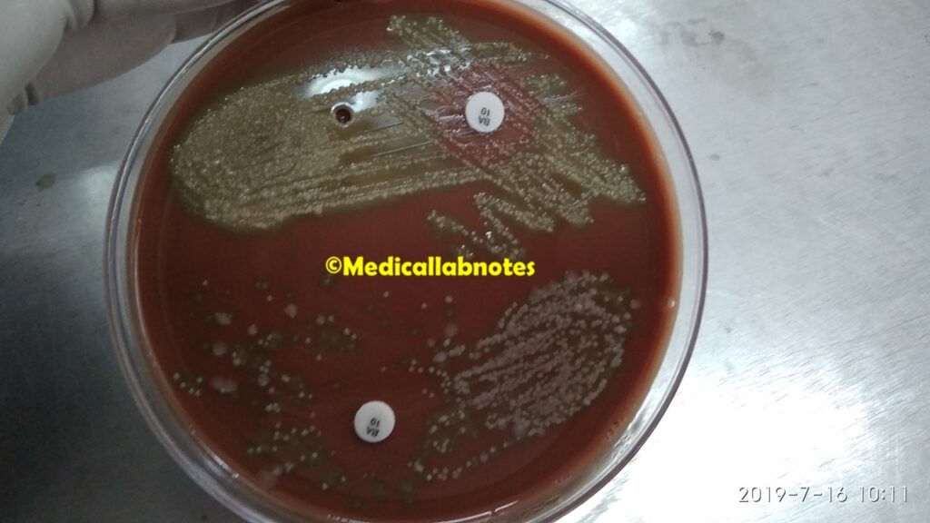 Haemophilus growth around bacitracin disk on chocolate agar of clinical specimen, sputum culture