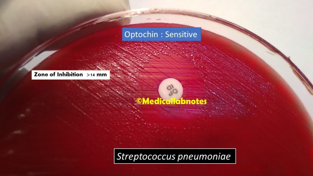 Optochin sensitive Streptococcus pneumoniae