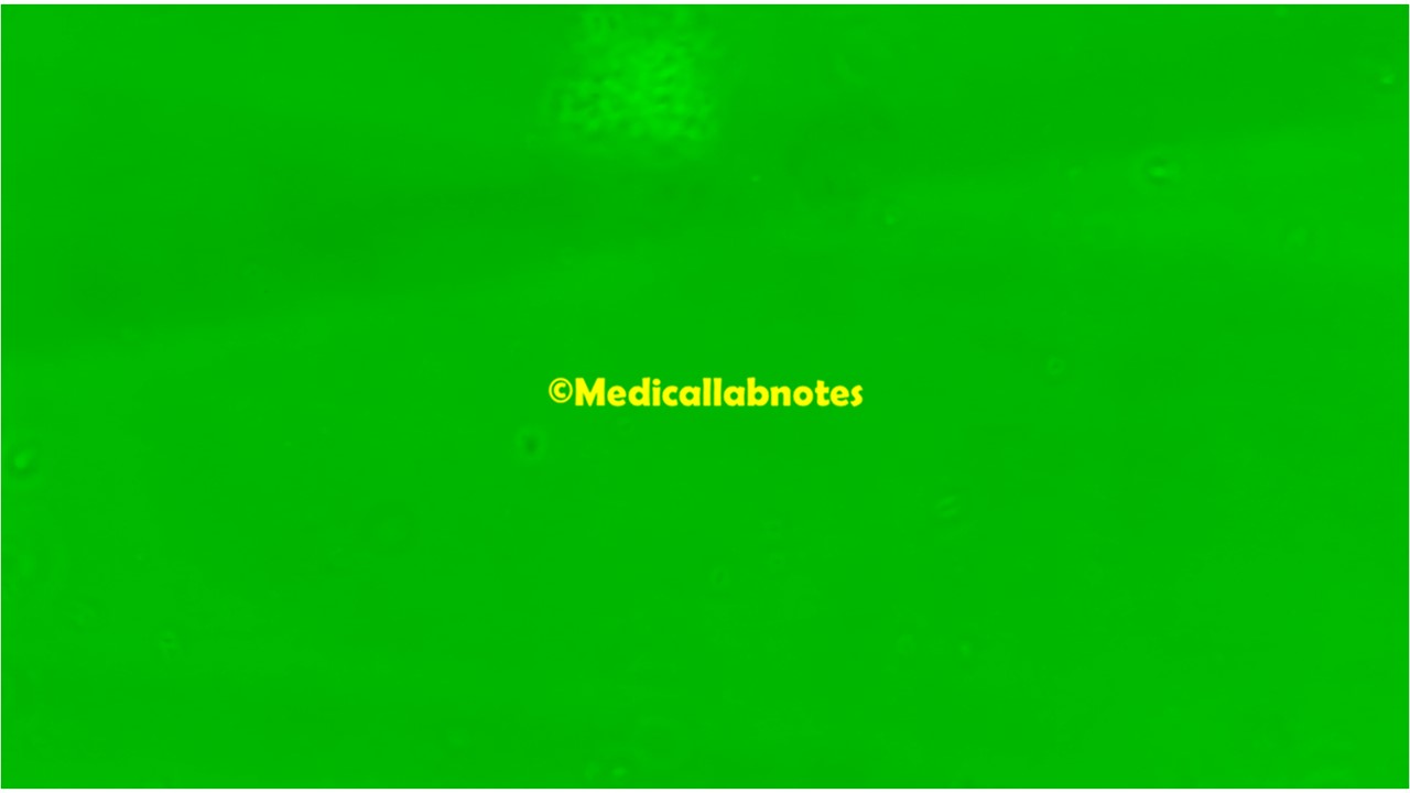 Streptococcus pneumoniae Introduction, Morphology, Pathogen