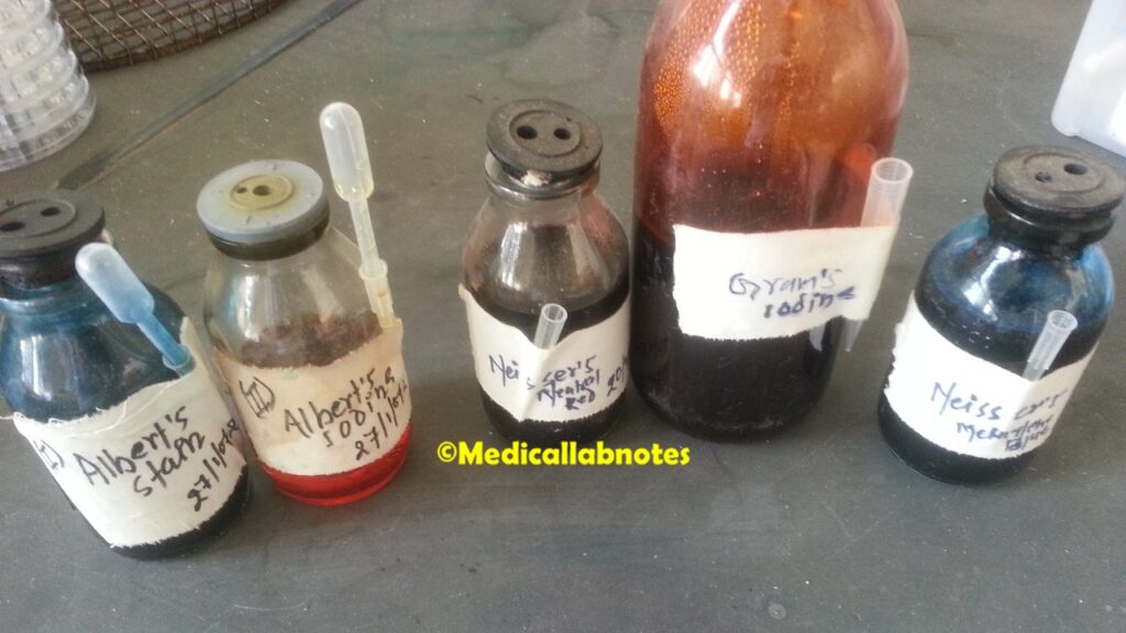 Self made Albert's stain and Neisser stain in Clinical Microbiology Laboratory