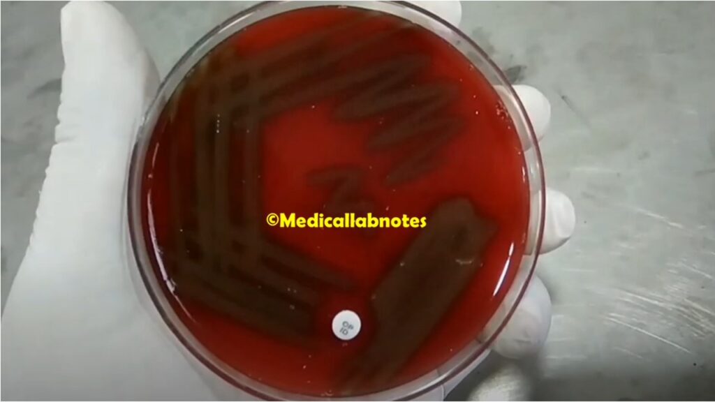 Streptococcus pneumoniae colony morphology on blood agar