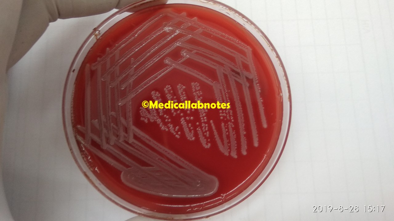 Streptococcus pyogenes colony morphology on blood agar