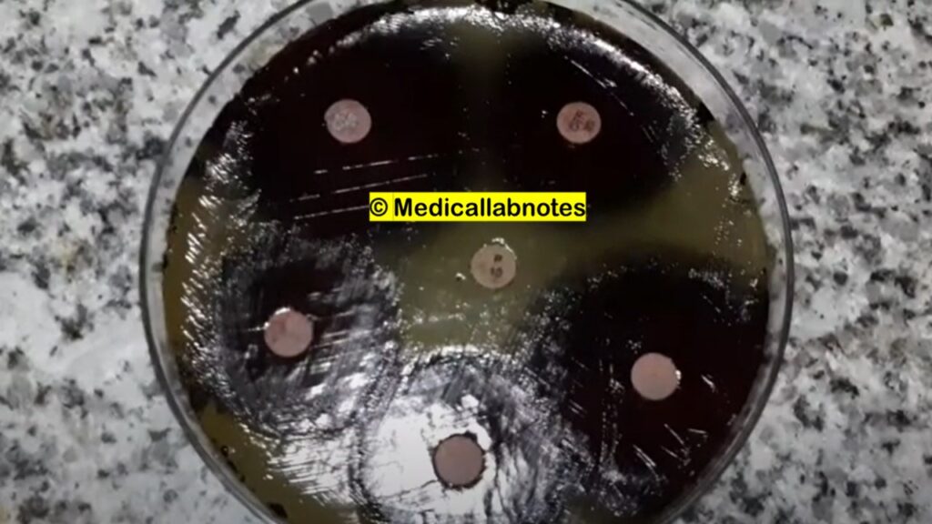 Antibiotics susceptibility testing (AST) of Micrococcus species