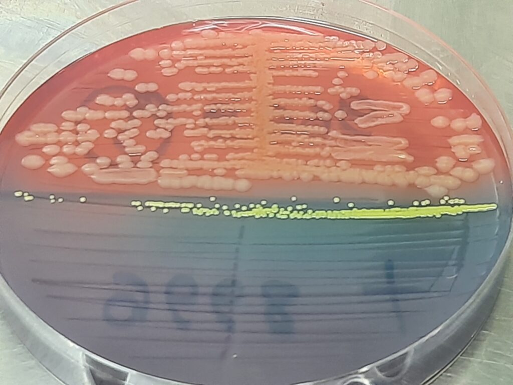 E. coli and Micrococcus luteus growth on CLED agar