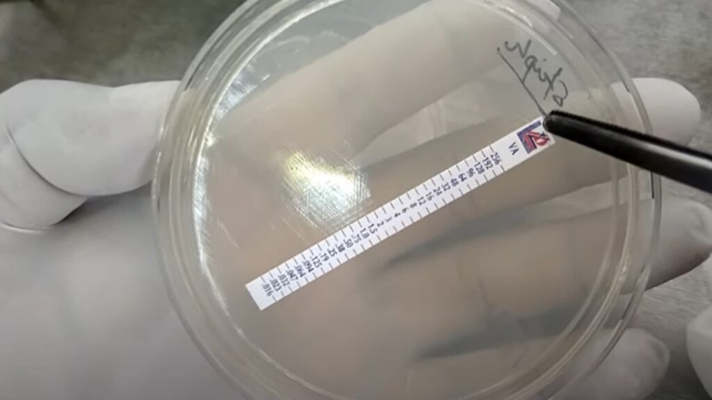 Placing Vancomycin E-Test Strip for Staphylococcus aureus