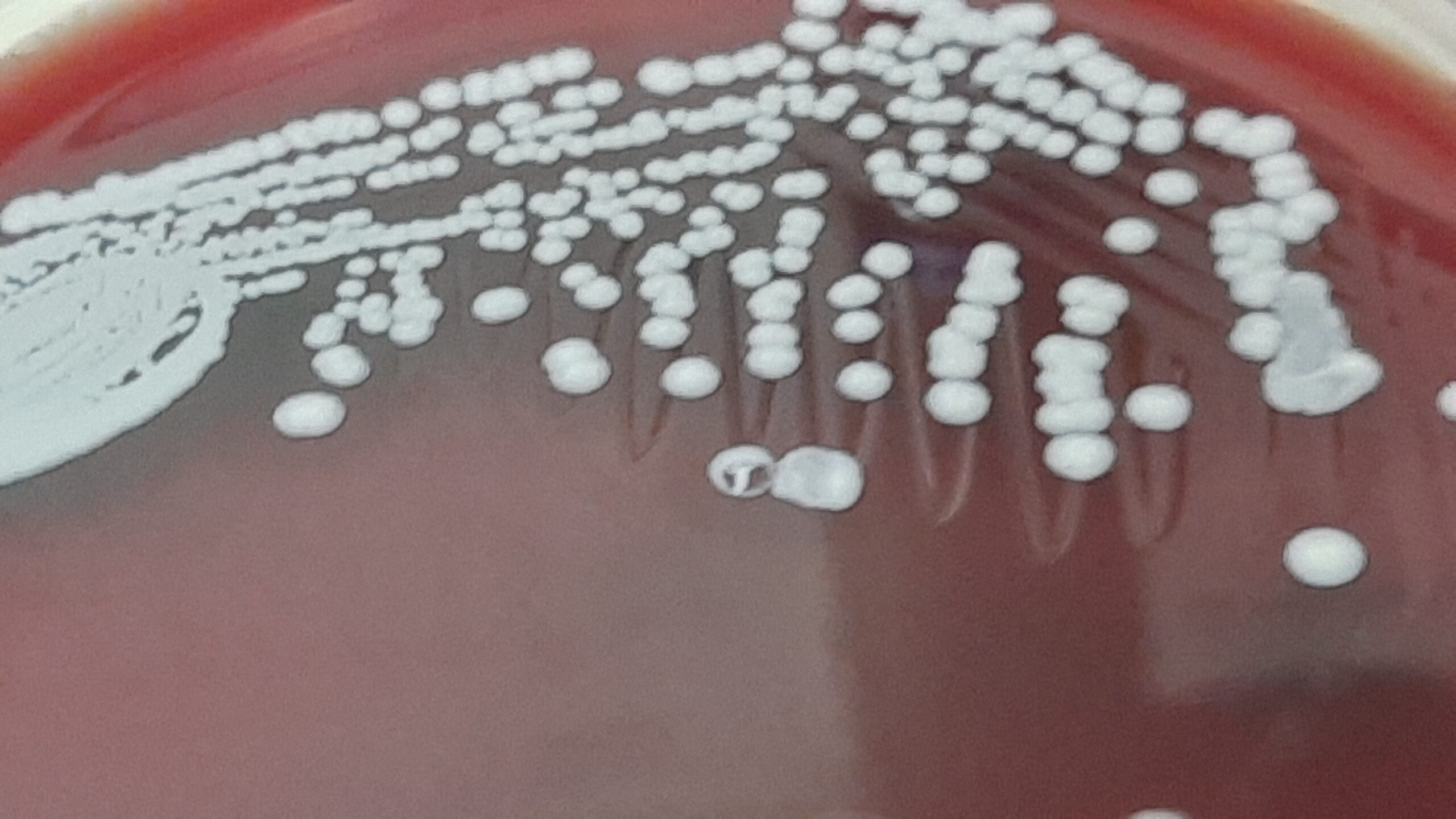 Staphylococcus epidermidis Colony Characteristics on Blood agar