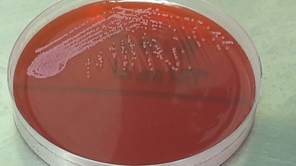 Staphylococcus epidermidis Colony Morphology on MacConkey agar from subculturing of Positive or turbid BD Bactec Vial