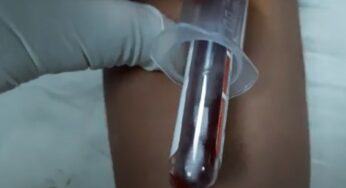 Medical Notes - This site is fully related to medical laboratory ...