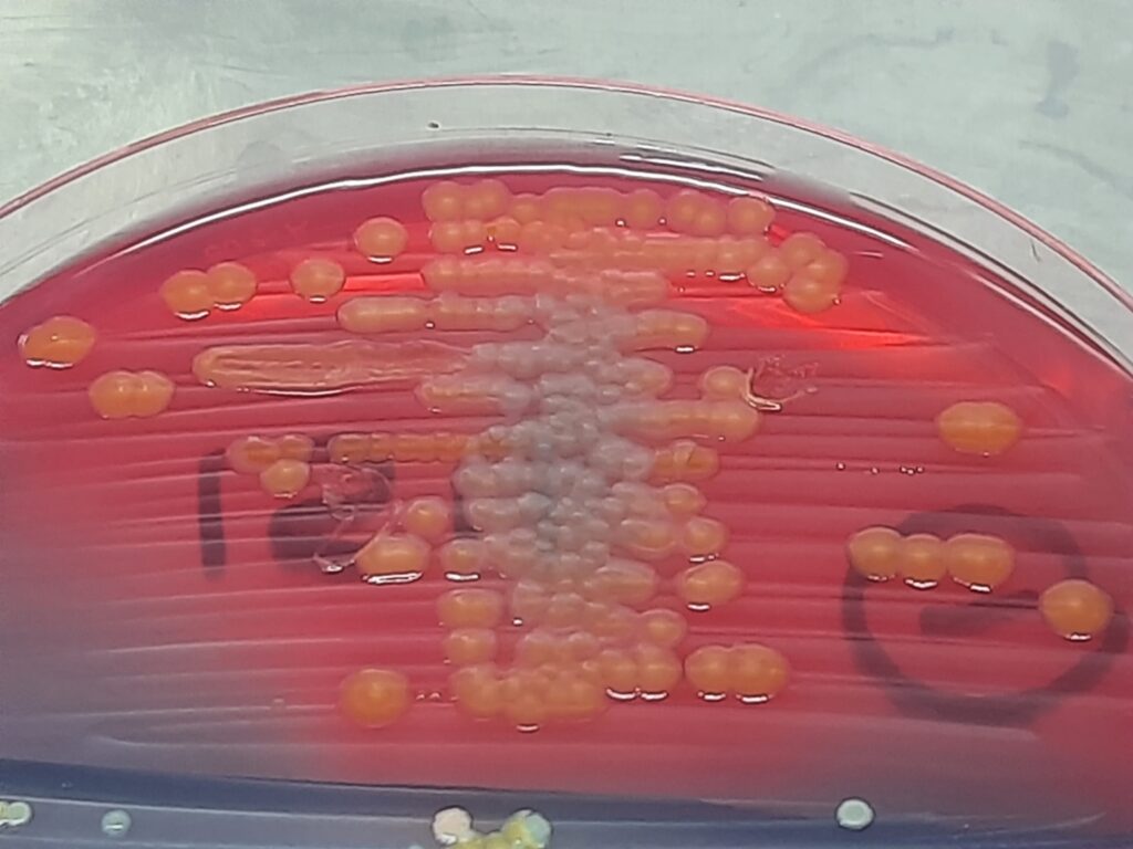 Citrobacter farmeri colony morphology on CLED agar