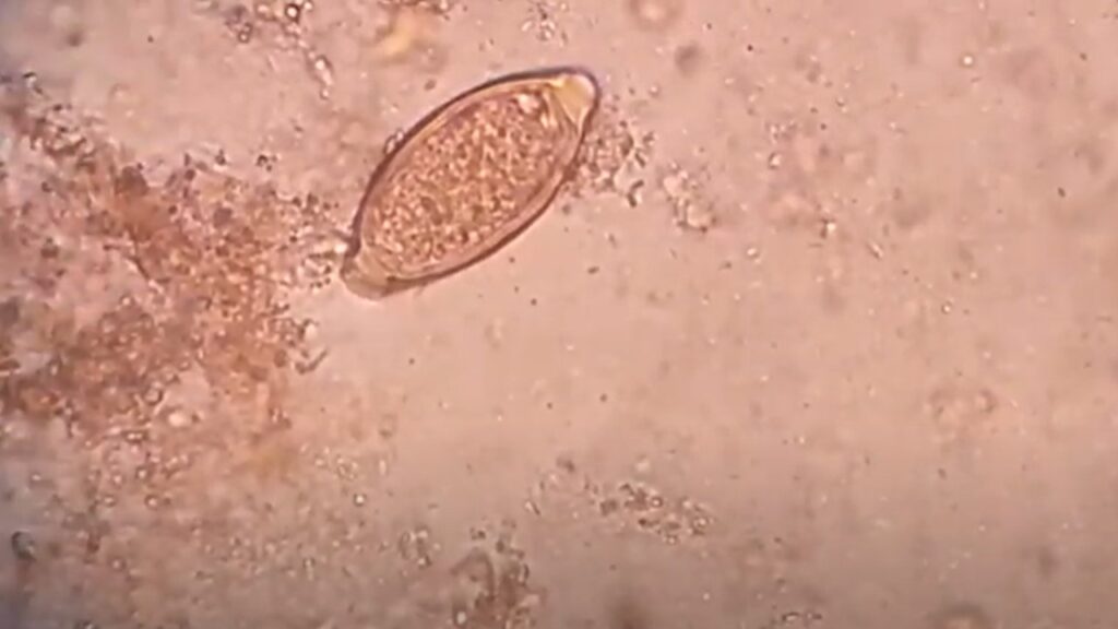 Egg of Trichuris trichura or Whipworm