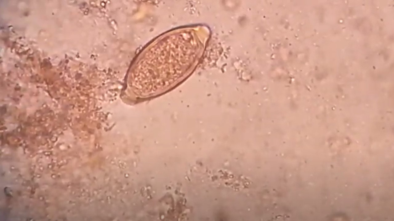 Egg of Trichuris trichura or Whipworm