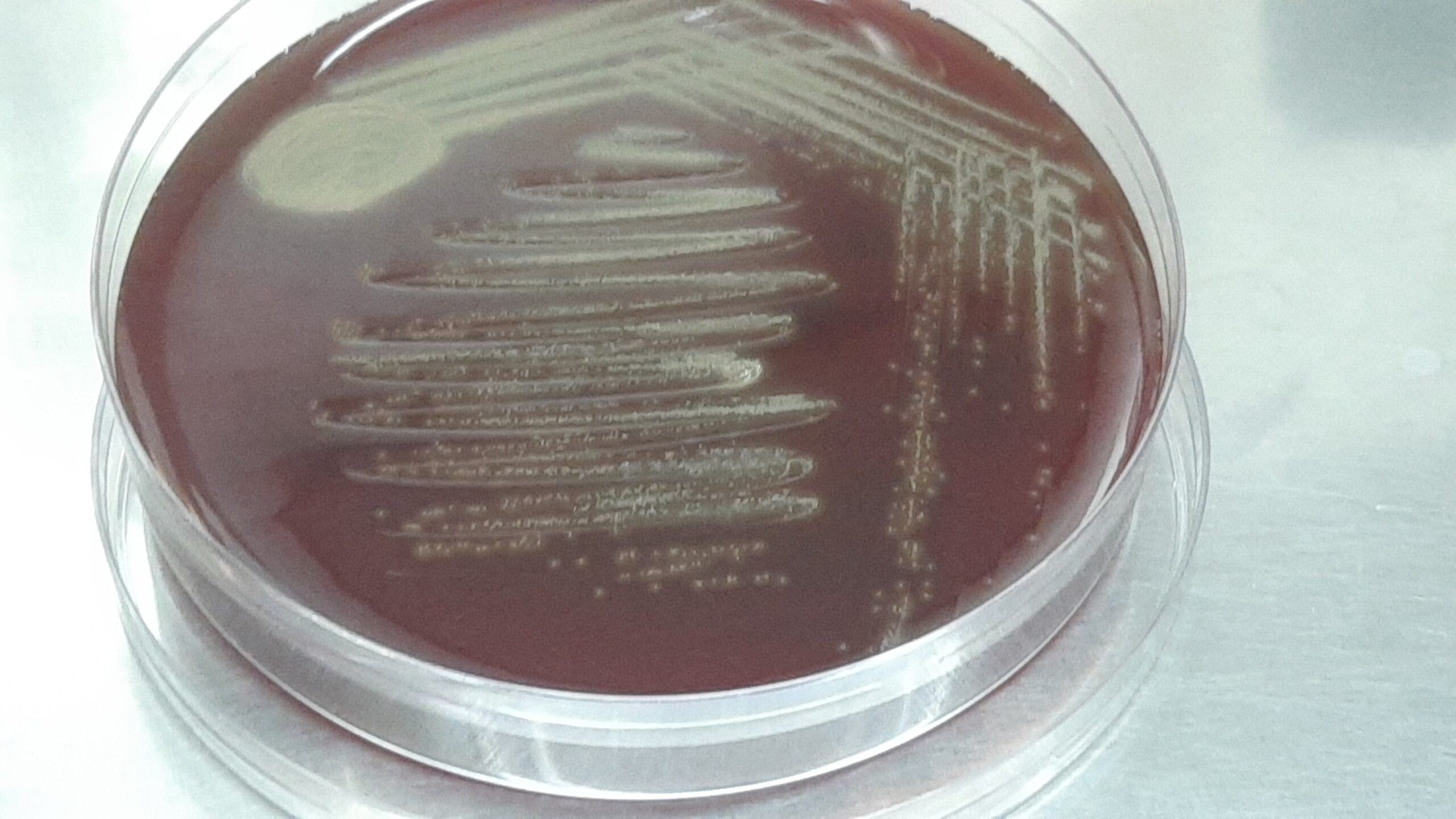 Gemella morbillorum colony morphology on blood agar of blood culture