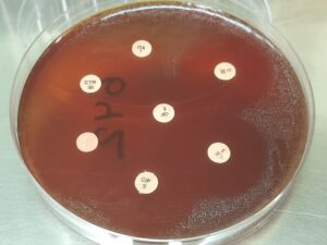 Strep Ast Example Streptococcus sanguinis-Introduction, Morphology, Pathogeni