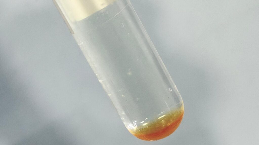 Nocardia colony morphology in Middlebrook 7H9 broth