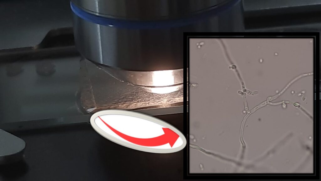 Fungal microscopy Archives - Medical Notes