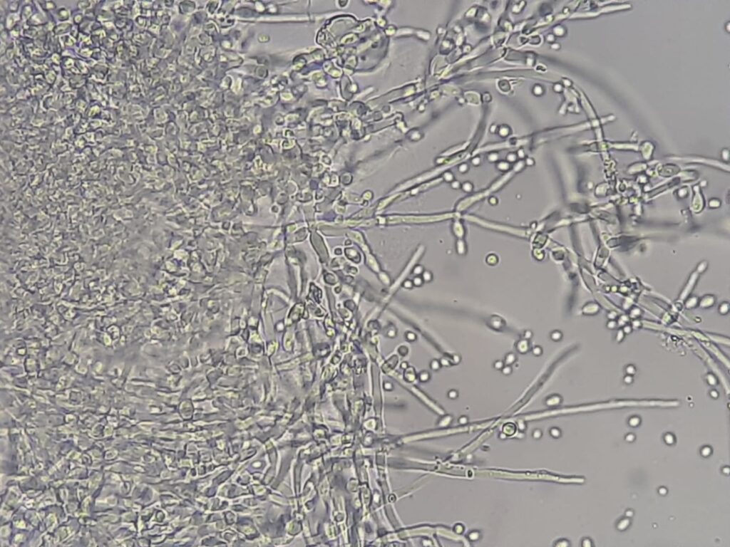 Candida Albicans Introduction Morphology Pathogenicity Lab