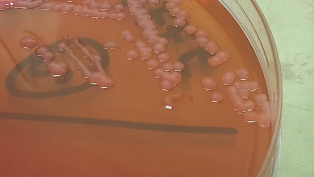 Acinetobacter baumannii colony morphology on MacConkey agar of sputum culture