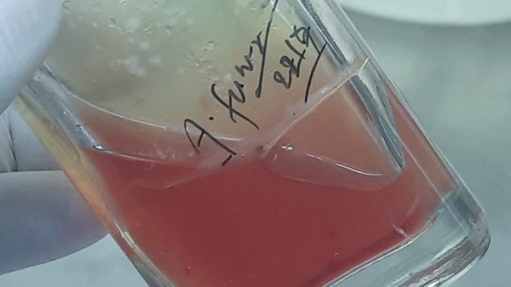 Aspergillus fumigatus colony morphology in a biphasic blood culture bottle containing both liquid and solid agar phases