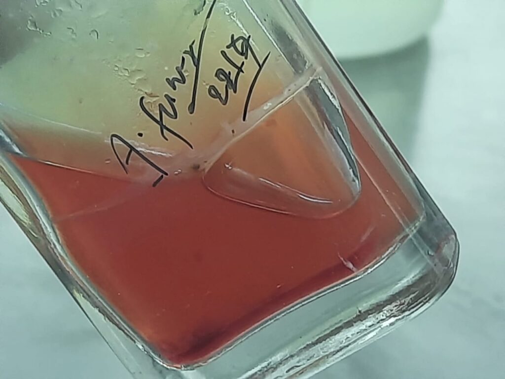Aspergillus fumigatus growth in a blood culture bottle containing both liquid and solid agar phases