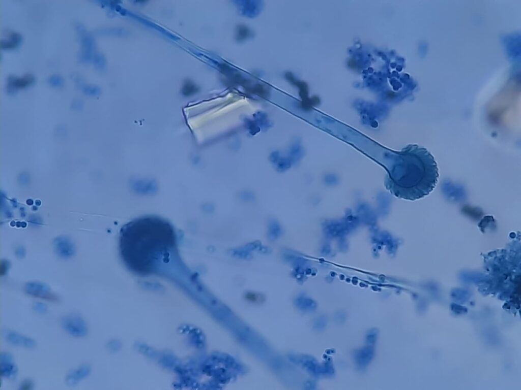 Aspergillus fumigatus in LPCB tease mount of culture microscopic image at a magnification of 1600X