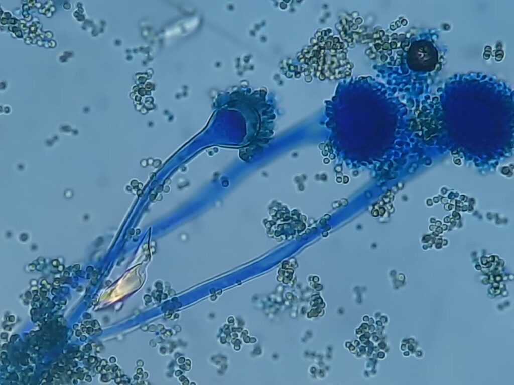 Aspergillus structures in LPCB preparation of growth