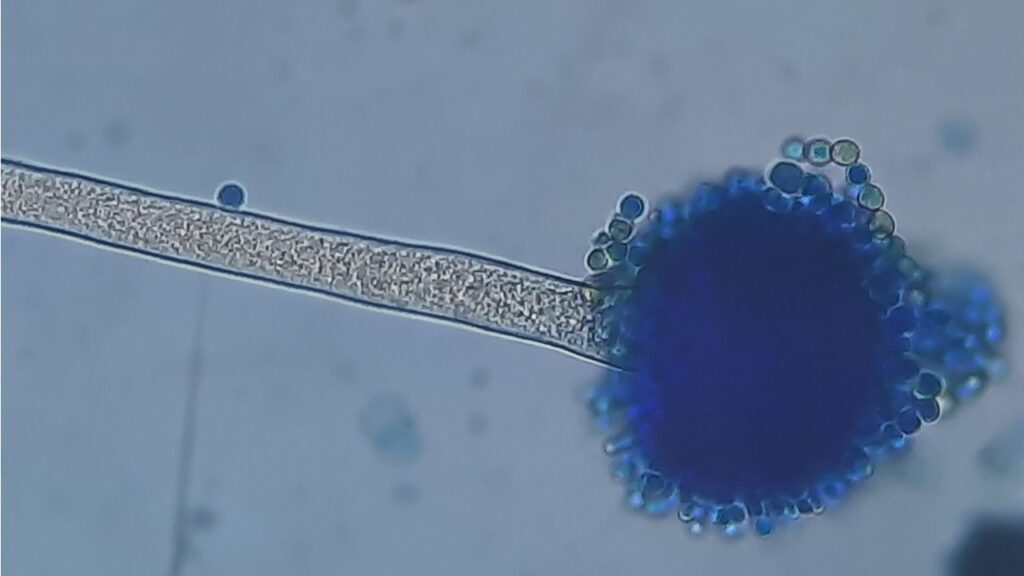 Aspergillus typical structure in LPCB preparation of fungal growth on SDA