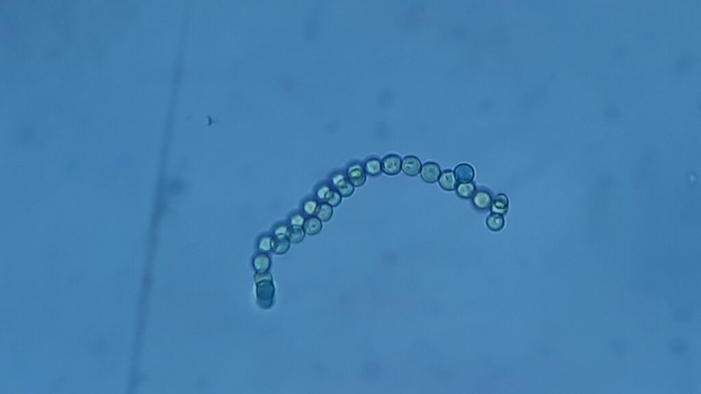 Conidia of Aspergillus in LPCB preparation
