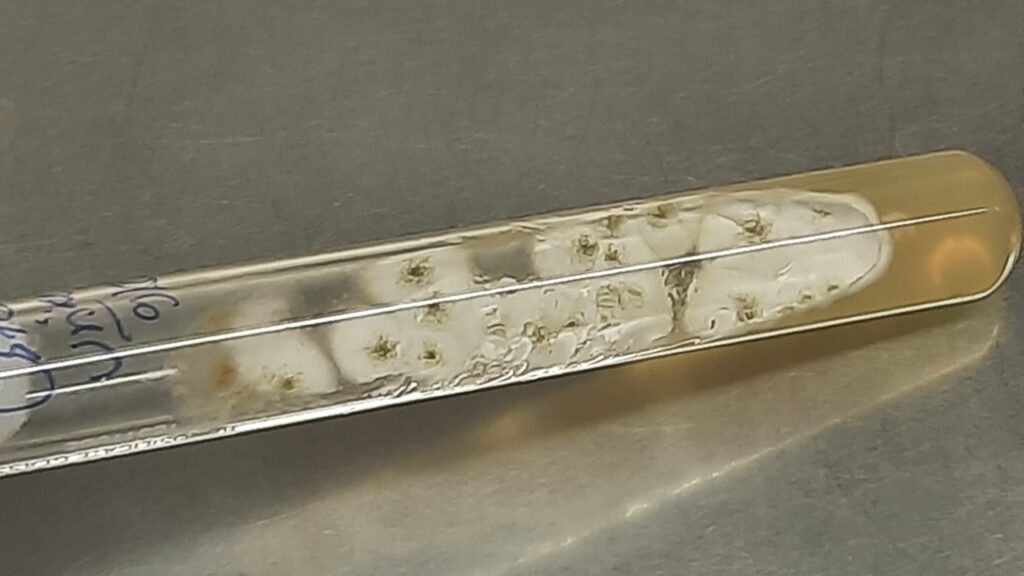 Fungal growth on Sabouraud dextrose agar after 5 days of incubation at 37 °C