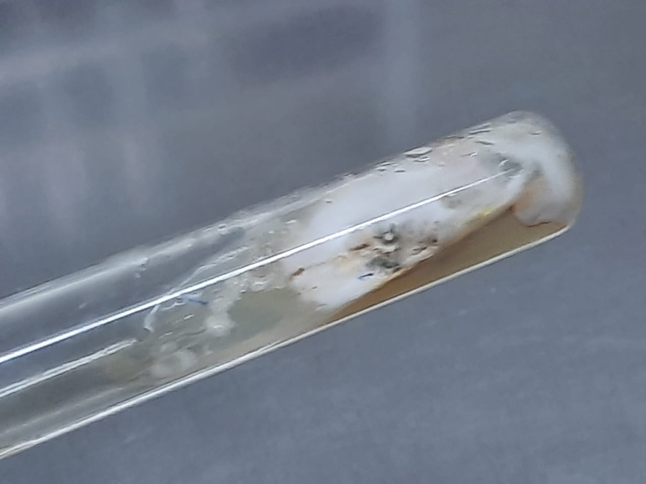 Yeast and mold mixed growth on SDA