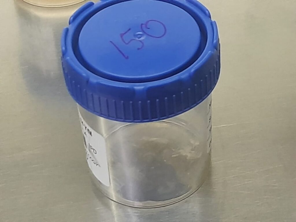 Sputum for fungal culture