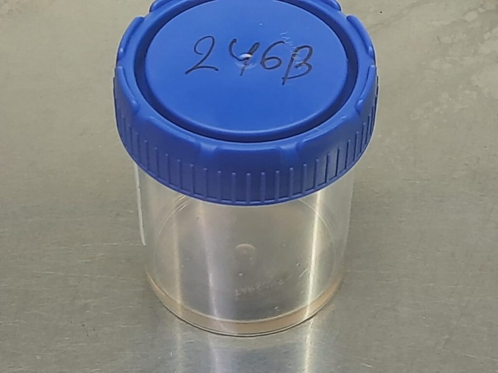 Urine for fungal culture